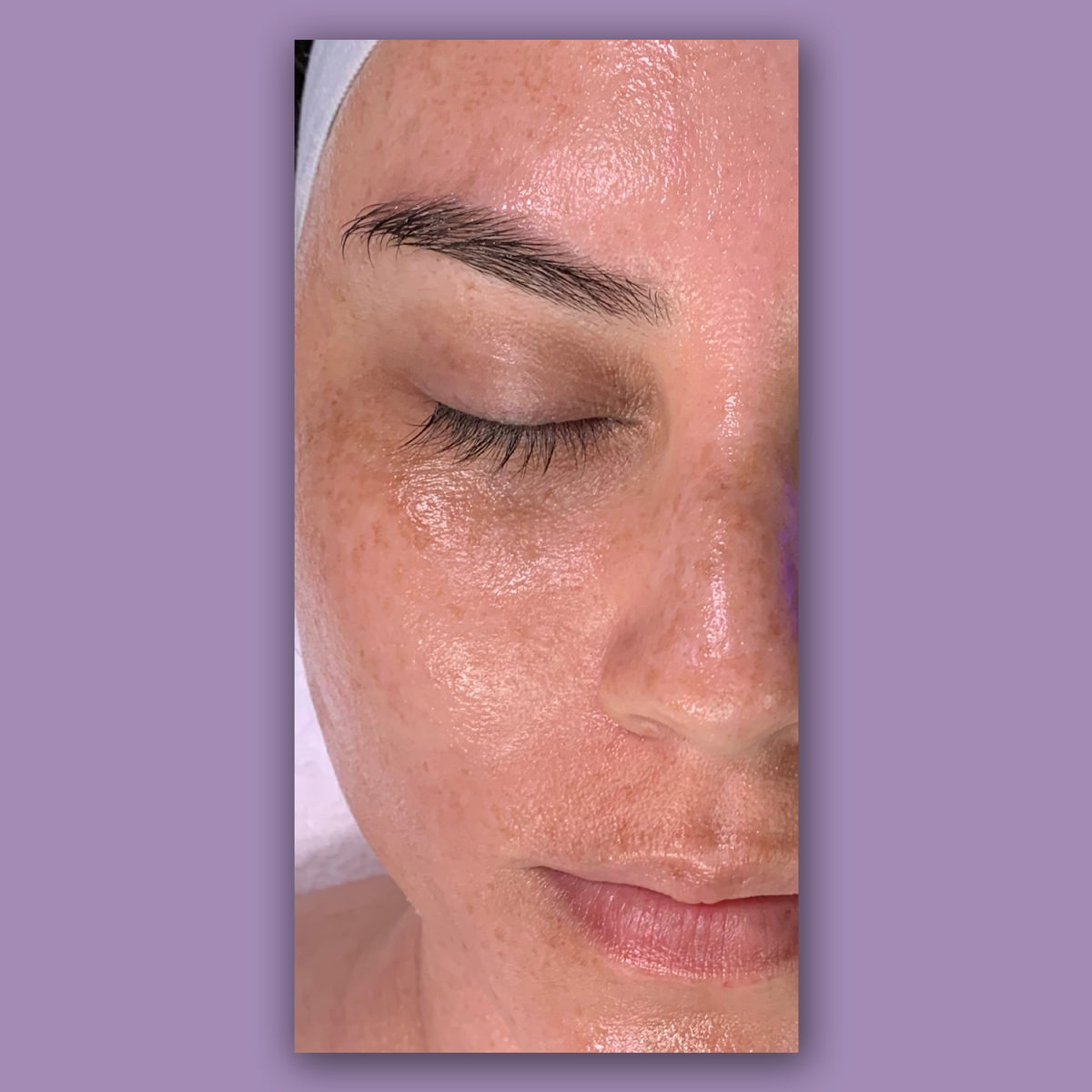 Hydrated Skin Facial After